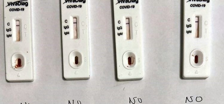 Alcalà-Alcossebre realitza tests immunològics a Policia Local, Servei d’Ajuda a domicili i voluntaris de Banc d’Aliments i no es detecta cap positiu en COVID-19